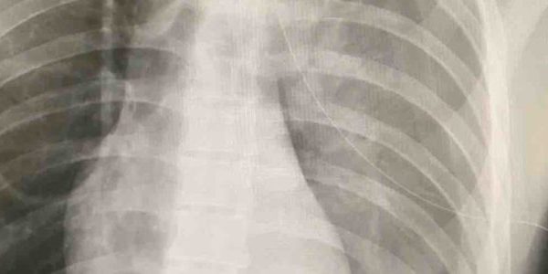 EP Monthly: Rattlesnakes, Stabbings, Hyperthermia and a Visualized Appendicitis? Music Fest Medical Care Recap