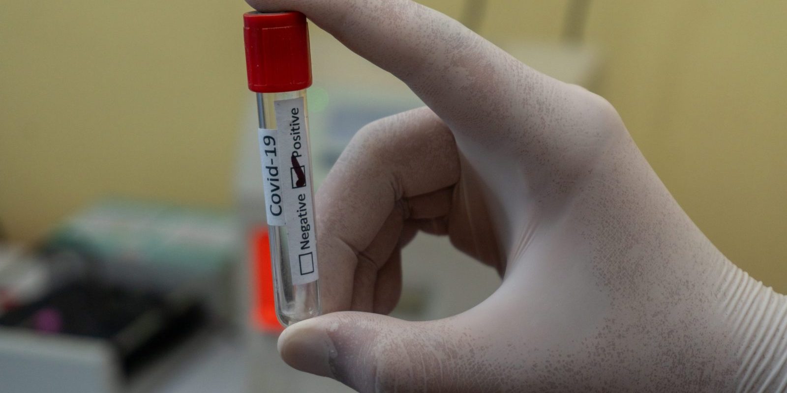 COVID-19 Situation Summary